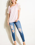 e Luna Striped Lace Patch Boxy Top